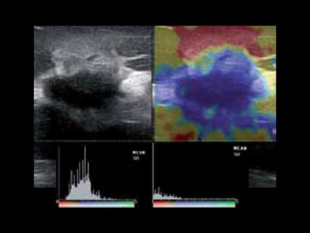 Esaote MyLab Class C