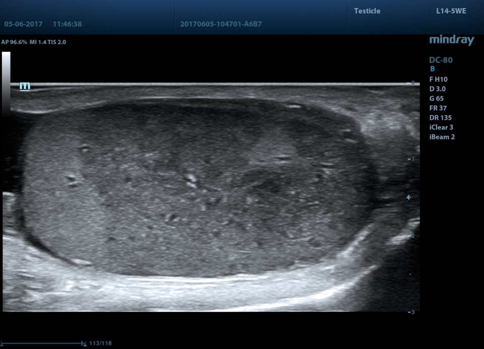 Mindray DC-80 X-Insight