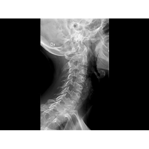 Рентген аппарат GE Optima XR 646