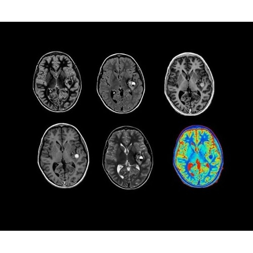 МРТ аппарат GE SIGNA PET/MR 3.0T